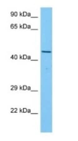 AIBZIP Rabbit anti-Human, Polyclonal, Novus Biologicals 100 &mu;g | Buy Online | Novus Biologicals | Fisher Scientific